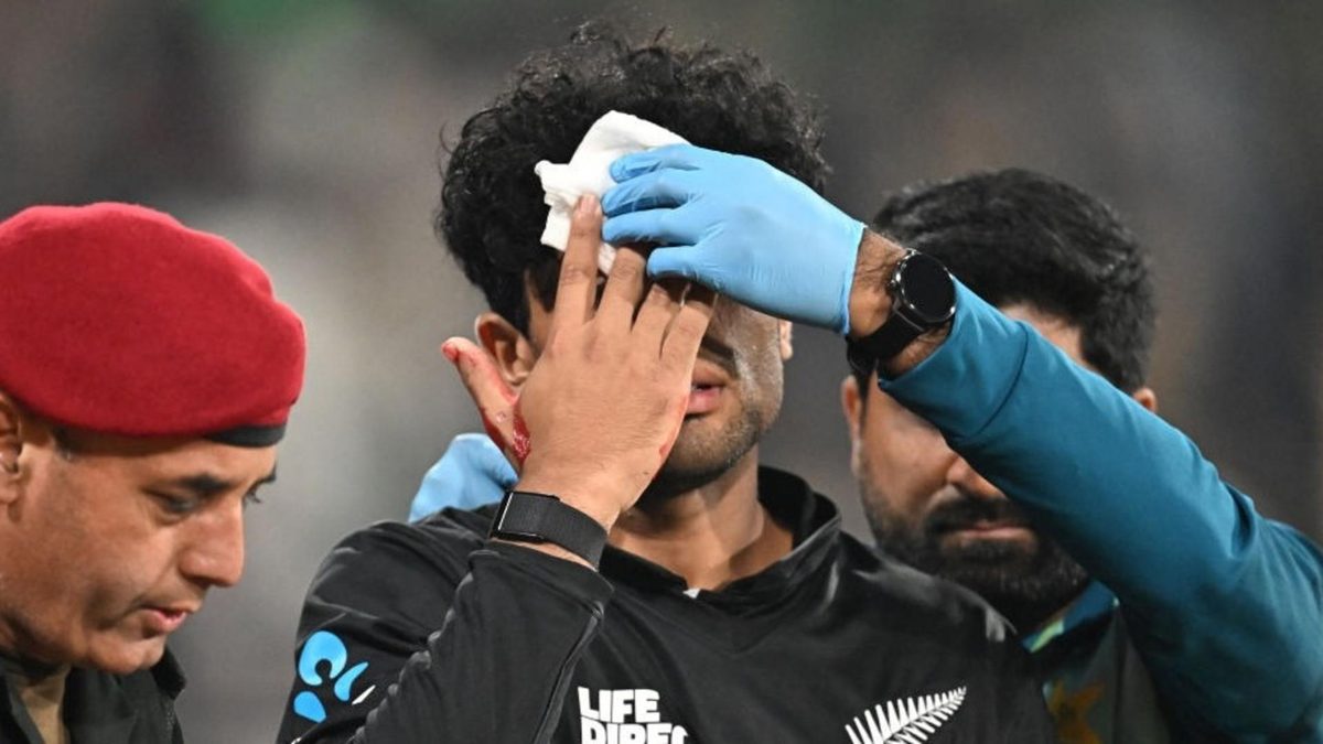 New Zealand Cricket (NZC) have provided an update on the injury sustained by opener Rachin Ravindra during the first ODI of their tri-series, against Pakistan.
