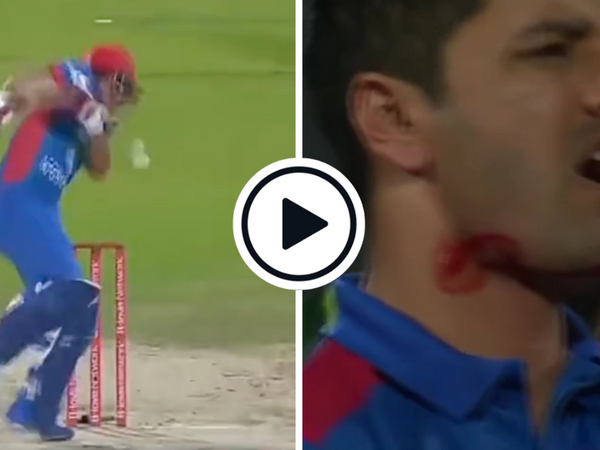 watch-najibullah-zadran-forced-retire-hurt-hit-chin-vicious-ihsanullah-bouncer.Click to read full article.